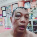 Hingga bibirnya berdarah Pada hari sabtu 25,/03/23 dengan bukti Paralon .cctv.kaos yg penuh darah dan Visum et Repertum saksi saksi di TKP Kost.